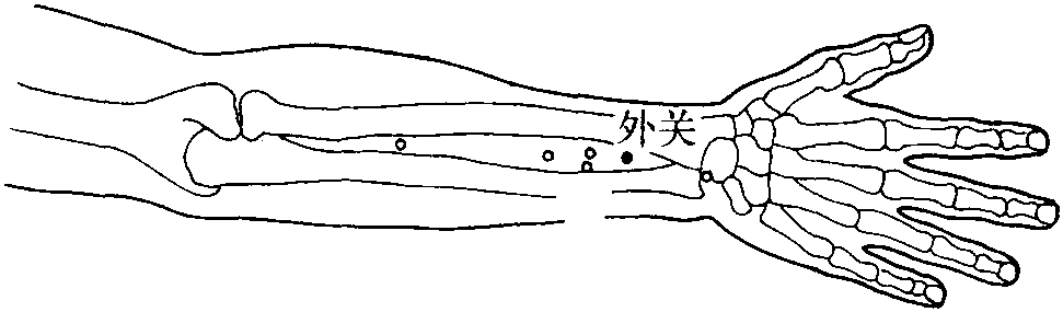 第二節(jié) 頭痛